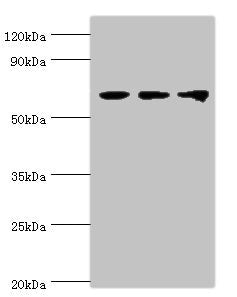 Western blot All lanes: Probable ATP-dependent RNA helicase DDX5 antibody at 3ug/ml Lane 1: NIH/3T3 whole cell lysate Lane 2: Hela whole cell lysate Lane 3: 293T whole cell lysate Secondary Goat polyclonal to rabbit IgG at 1/10000 dilution Predict...