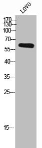 Western Blot analysis of LOVO cells using CRMP-3 Polyclonal Antibody
