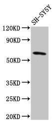 Western Blot Positive WB detected in: SH-SY5Y whole cell lysate All lanes: DEAF1 antibody at 3.2ug/ml Secondary Goat polyclonal to rabbit IgG at 1/50000 dilution Predicted band size: 60, 59, 53, 52 kDa Observed band size: 60 kDa