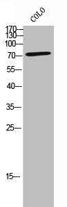 Western Blot analysis of colo cells using OATP-C Polyclonal Antibody