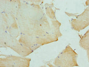 Immunohistochemistry of paraffin-embedded human skeletal muscle tissue using CSB-PA006655ESR2HU at dilution of 1:100