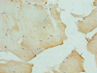Immunohistochemistry of paraffin-embedded human skeletal muscle tissue using CSB-PA006655ESR2HU at dilution of 1:100