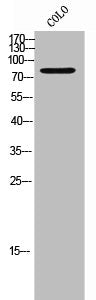 Western Blot analysis of COLO cells using TRIM3 Polyclonal Antibody