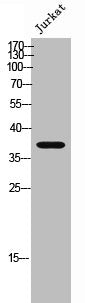 Western Blot analysis of Jurkat cells using Peropsin Polyclonal Antibody