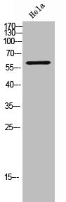 Western Blot analysis of HeLa cells using TCP-1 θ Polyclonal Antibody