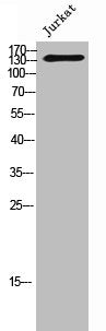 Western Blot analysis of Jurkat cells using STAG3 Polyclonal Antibody