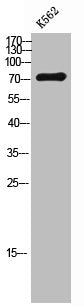 Western Blot analysis of K562 cells using MASP-2 Polyclonal Antibody