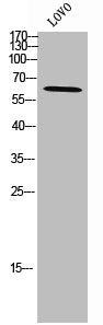 Western Blot analysis of LOVO cells using ZNF460 Polyclonal Antibody