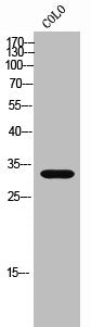 Western Blot analysis of CoLo cells using StARD10 Polyclonal Antibody