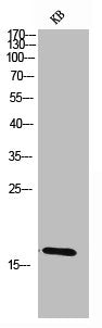 Western Blot analysis of KB cells using Choriogonadotropin β Polyclonal Antibody