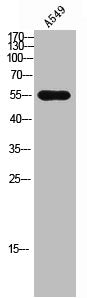 Western Blot analysis of A549 cells using CD3EAP Polyclonal Antibody