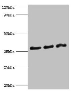 Western blot All lanes: DFFA antibody at 10ug/ml Lane 1: Hela whole cell lysate Lane 2: 293T whole cell lysate Lane 3: PC-3 whole cell lysate Secondary Goat polyclonal to rabbit IgG at 1/10000 dilution Predicted band size: 37, 30 kDa Observed band...