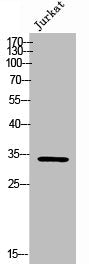 Western Blot analysis of Jurkat cells using Rab 40B Polyclonal Antibody