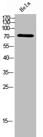 Western Blot analysis of Hela cells using ACSVL6 Polyclonal Antibody