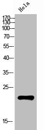 Western Blot analysis of HeLa cells using Rab 31 Polyclonal Antibody