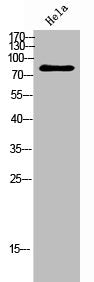 Western Blot analysis of Hela cells using OGFR Polyclonal Antibody