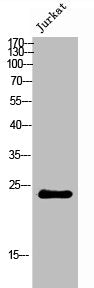 Western Blot analysis of Jurkat cells using CYB561D2 Polyclonal Antibody