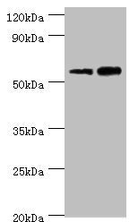 Western blot All lanes: Non-syndromic hearing impairment protein 5 antibody at 10ug/ml Lane 1: Hela whole cell lysate Lane 2: HepG2 whole cell lysate Secondary Goat polyclonal to rabbit IgG at 1/10000 dilution Predicted band size: 55, 11, 37 kDa O...