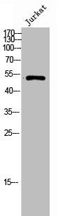 Western Blot analysis of JK cells using Coronin 1A Polyclonal Antibody