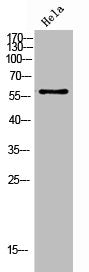 Western Blot analysis of Hela cells using Phospho-Chk2 (T383) Polyclonal Antibody
