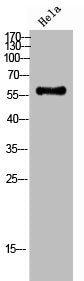 Western Blot analysis of Hela cells using Phospho-Chk2 (T387) Polyclonal Antibody