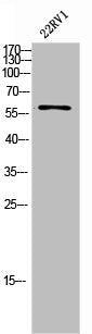 Western Blot analysis of 22RV1 cells using Chk2 Polyclonal Antibody
