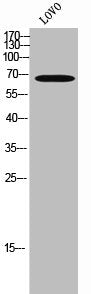 Western Blot analysis of LOVO cells using IRAK-M Polyclonal Antibody