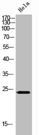 Western Blot analysis of HeLa cells using CHP Polyclonal Antibody