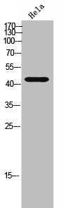 Western Blot analysis of HeLa cells using mAChR M2 Polyclonal Antibody