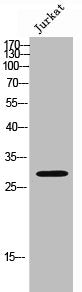 Western Blot analysis of JK cells using Med8 Polyclonal Antibody