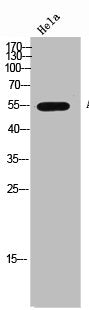 Western Blot analysis of Hela cells using AChRβ1 Polyclonal Antibody