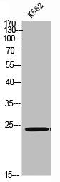 Western blot analysis of K562 using p-TIRAP (Y86) antibody.