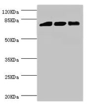 Western blot All lanes: DGKA antibody at 6.48µg/ml Lane 1: Hela whole cell lysate Lane 2: Jurkat whole cell lysate Lane 3: 293T whole cell lysate Secondary Goat polyclonal to rabbit IgG at 1/10000 dilution Predicted band size: 83, 14, 29 kDa Obser...