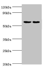 Western blot All lanes: Diacylglycerol kinase epsilon antibody at 5ug/ml Lane 1: Rat brain tissue Lane 2: Hela whole cell lysate Secondary Goat polyclonal to rabbit IgG at 1/10000 dilution Predicted band size: 64, 21 kDa Observed band size: 64 kDa