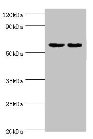 Western blot All lanes: Diacylglycerol kinase epsilon antibody at 5ug/ml Lane 1: Rat brain tissue Lane 2: Hela whole cell lysate Secondary Goat polyclonal to rabbit IgG at 1/10000 dilution Predicted band size: 64, 21 kDa Observed band size: 64 kDa