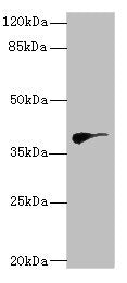 Western blot All lanes: DHDDSantibody at 2.97ug/ml + Hela whole cell lysate Secondary Goat polyclonal to rabbit IgG at 1/10000 dilution Predicted band size: 39, 35 kDa Observed band size: 39 kDa