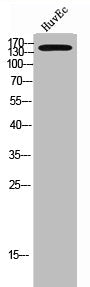 Western Blot analysis of HuvEc cells using A Cyclase IX Polyclonal Antibody