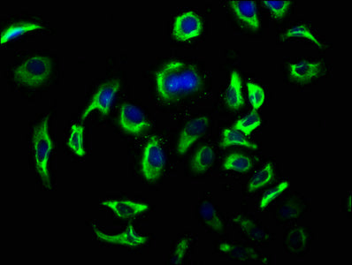 Immunofluorescence staining of A549 cells with CSB-PA006851LA01HU at 1:100, counter-stained with DAPI. The cells were fixed in 4% formaldehyde, permeabilized using 0.2% Triton X-100 and blocked in 10% normal Goat Serum. The cells were then incubat...
