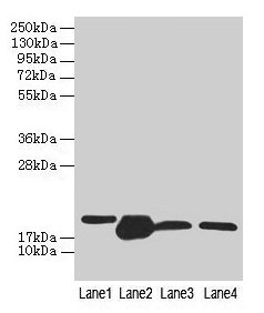 Western blot All lanes: DHRS3 antibody at 0.8µg/ml Lane 1: A375 whole cell lysate Lane 2: Mouse liver tissue Lane 3: Mouse spleen tissue Lane 4: HL60 whole cell lysate Secondary Goat polyclonal to rabbit IgG at 1/10000 dilution Predicted band size...