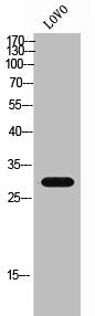 Western Blot analysis of LOVO cells using GPR146 Polyclonal Antibody