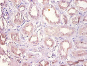 Immunohistochemistry of paraffin-embedded human kidney tissue using CSB-PA006867DA01HU at dilution of 1:100