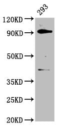 Western Blot Positive WB detected in: 293 whole cell lysate All lanes: DHX15 antibody at 3.7µg/ml Secondary Goat polyclonal to rabbit IgG at 1/50000 dilution Predicted band size: 91 kDa Observed band size: 91 kDa