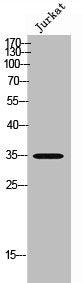 Western Blot analysis of JK cells using OSR2 Polyclonal Antibody