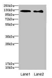 Western blot All lanes: DIAPH2 antibody at 4.75ug/ml Lane 1: 293T whole cell lysate Lane 2: Hela whole cell lysate Secondary Goat polyclonal to rabbit IgG at 1/10000 dilution Predicted band size: 126, 125 kDa Observed band size: 126 kDa
