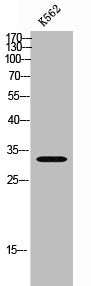 Western Blot analysis of K562 cells using CIB3 Polyclonal Antibody