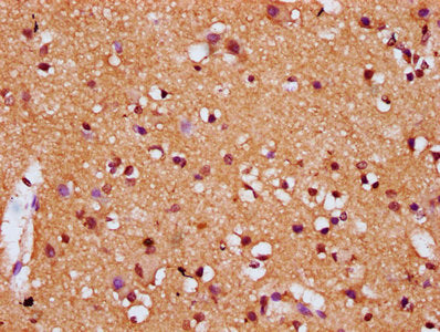IHC image of CSB-PA006905LA01HU diluted at 1:200 and staining in paraffin-embedded human brain tissue performed on a Leica BondTM system. After dewaxing and hydration, antigen retrieval was mediated by high pressure in a citrate buffer (pH 6.0). S...