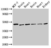 Western Blot Positive WB detected in: MCF-7 whole cell lysate, Rat brain tissue, Rat heart tissue, Mouse brain tissue, Mouse heart tissue, Mouse kidney tissue All lanes: DKC1 antibody at 2.5µg/ml Secondary Goat polyclonal to rabbit IgG at 1/50000...