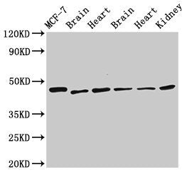 Western Blot Positive WB detected in: MCF-7 whole cell lysate, Rat brain tissue, Rat heart tissue, Mouse brain tissue, Mouse heart tissue, Mouse kidney tissue All lanes: DKC1 antibody at 2.5µg/ml Secondary Goat polyclonal to rabbit IgG at 1/50000...