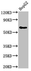 Western Blot Positive WB detected in: HepG2 whole cell lysate All lanes: DLAT antibody at 4ug/ml Secondary Goat polyclonal to rabbit IgG at 1/50000 dilution Predicted band size: 69 kDa Observed band size: 69 kDa
