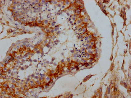 IHC image of CSB-PA006938LA01HU diluted at 1:100 and staining in paraffin-embedded human testis tissue performed on a Leica BondTM system. After dewaxing and hydration, antigen retrieval was mediated by high pressure in a citrate buffer (pH 6.0)....